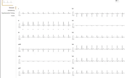 Corpuls Web – EKG-Übertragung